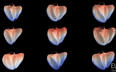Developing virtual twin hearts with Hybrid Cloud