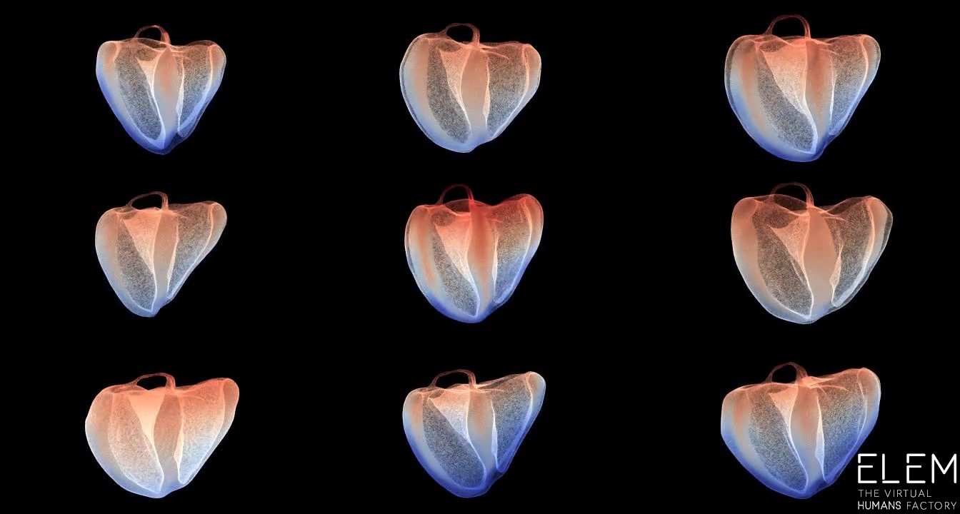 Developing virtual twin hearts with Hybrid Cloud